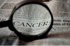 Tacoma WA Dentist | Oral Cancer Risk Factors